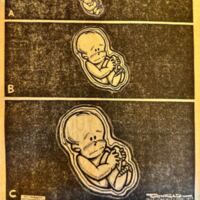 Fetus Viability 31 January 1973.jpg